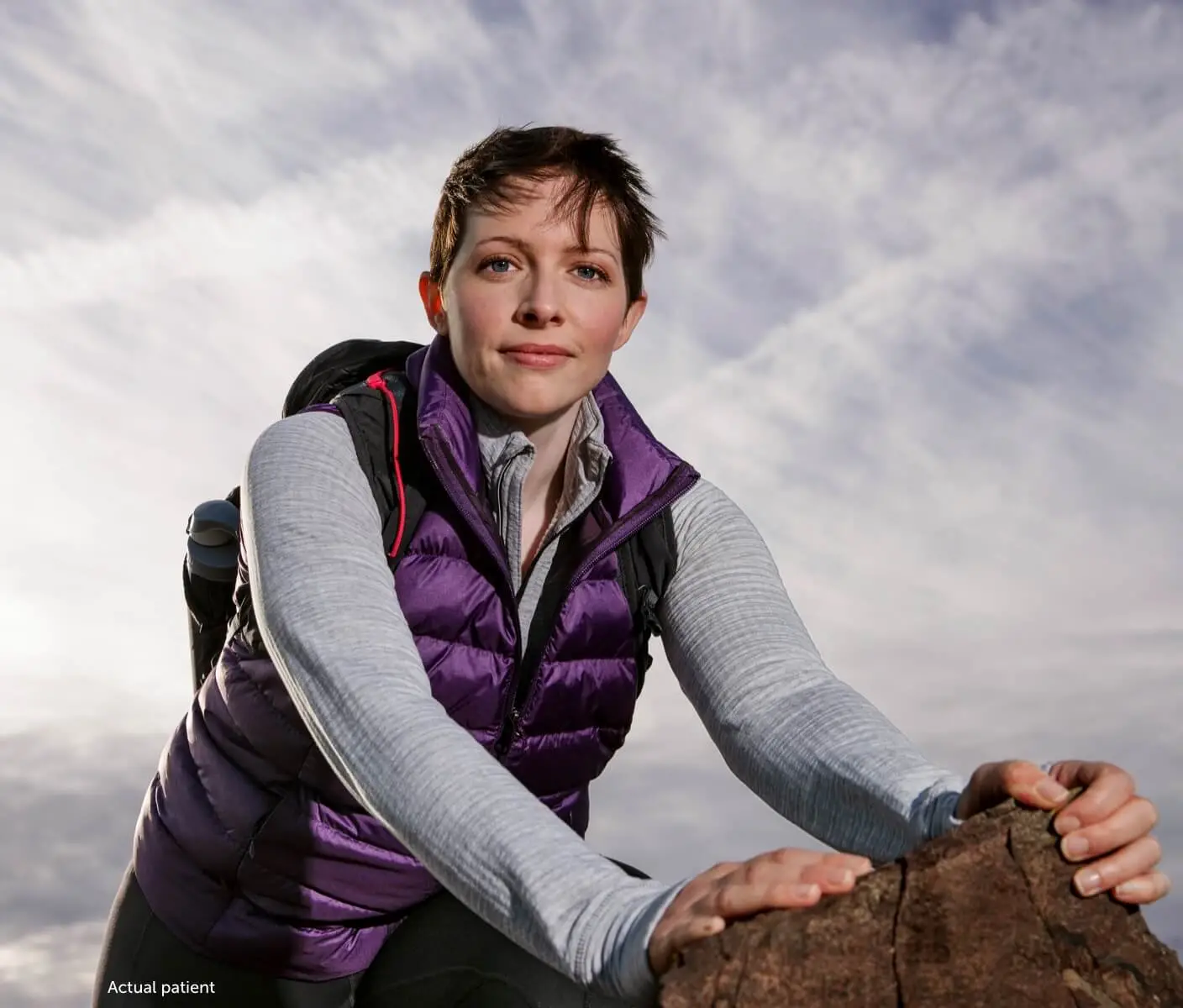 Leslie, a real VWD patient, standing on a rock with her outdoor outfit.