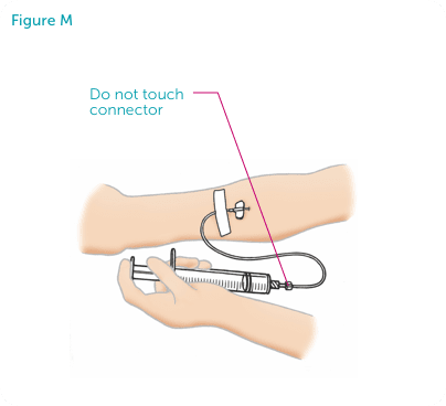 Hands administering VONVENDI® in the vein. Do not touch connector.